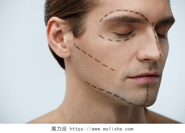 年轻男人的脸上有黑色的画好的虚线整形手术。英俊的男人脸上的线条的肖像 